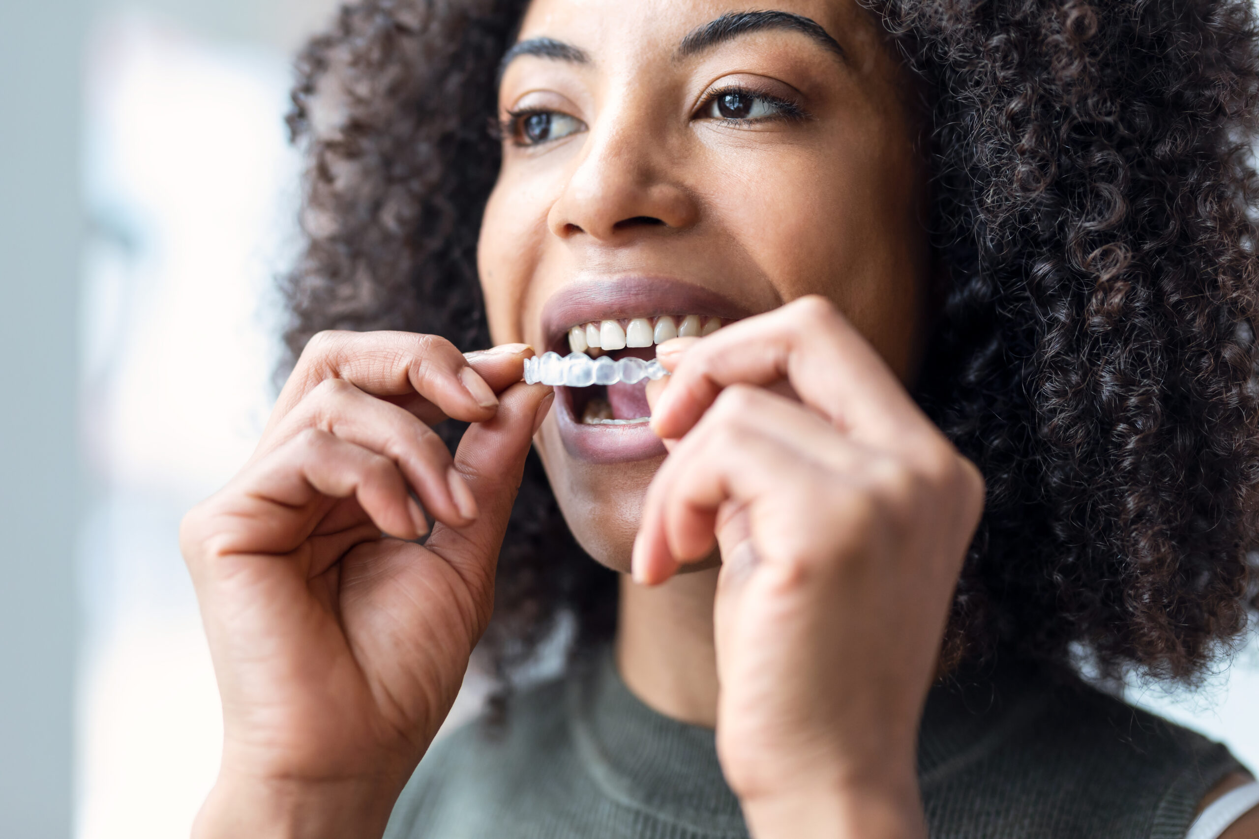 Patient wearing clear aligners during an Invisalign consultation