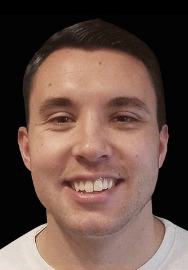 Boy Before Dental Image