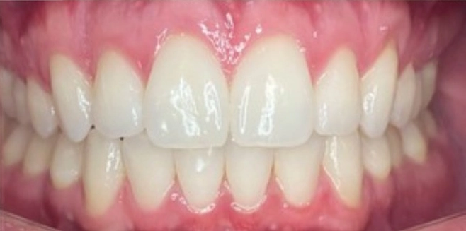 Dental After