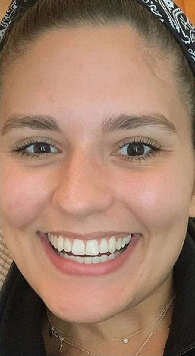 Girl After Dental Image