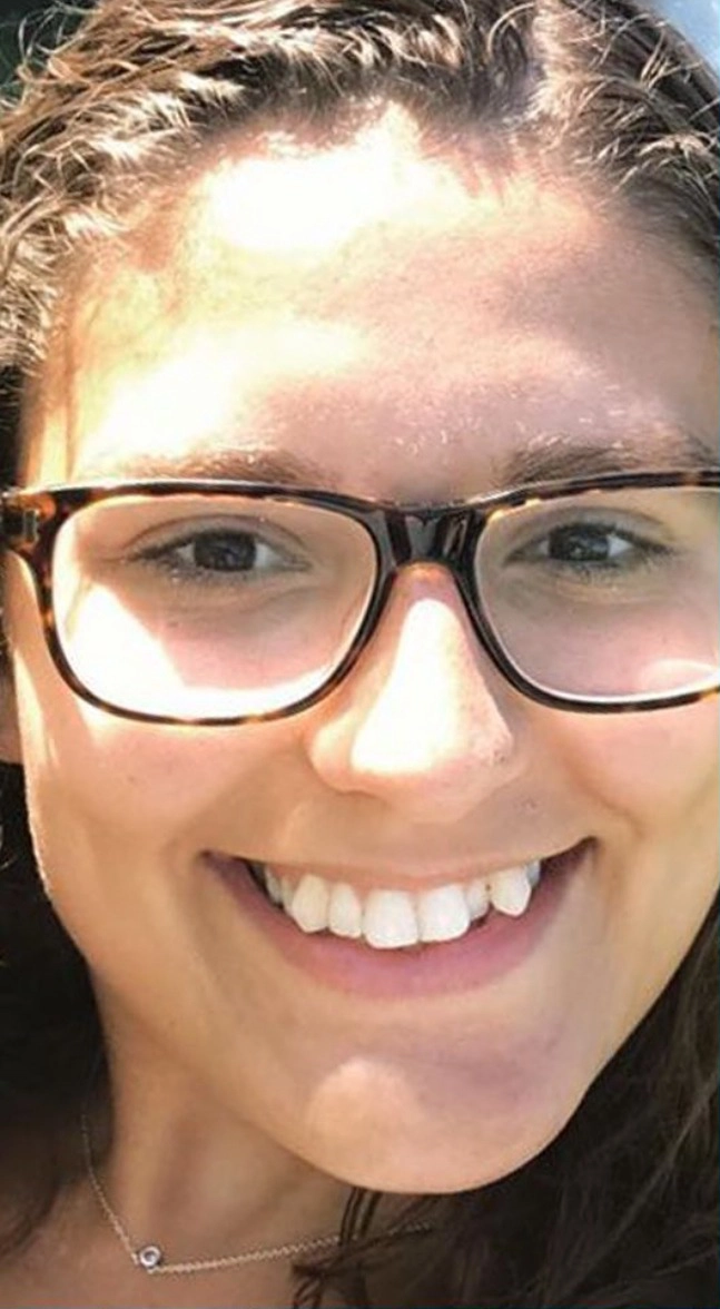 Girl Before Dental Image