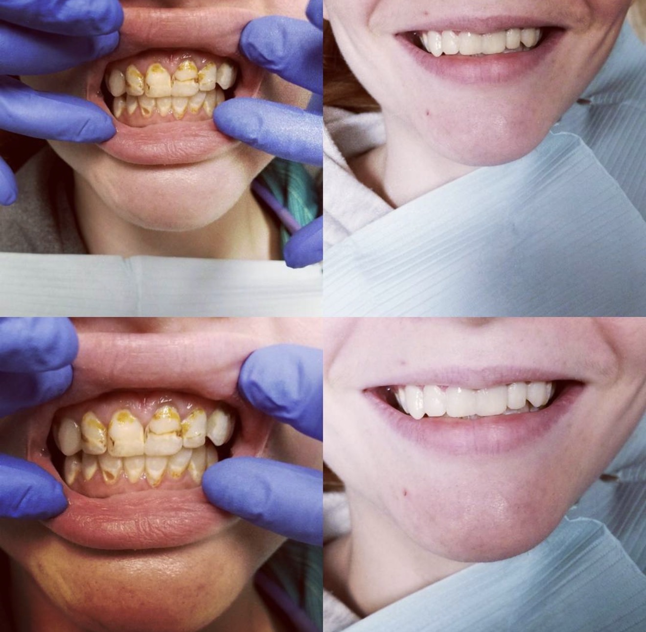 Before After 3